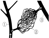 如图为三种血管关系示意图,请你据图回答下列问题