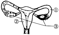 如图一是男,女染色体图谱,图二为人类生殖过程中的性别决定图解.